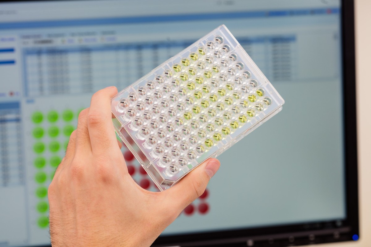 ELISA plate with positive and negative reactions